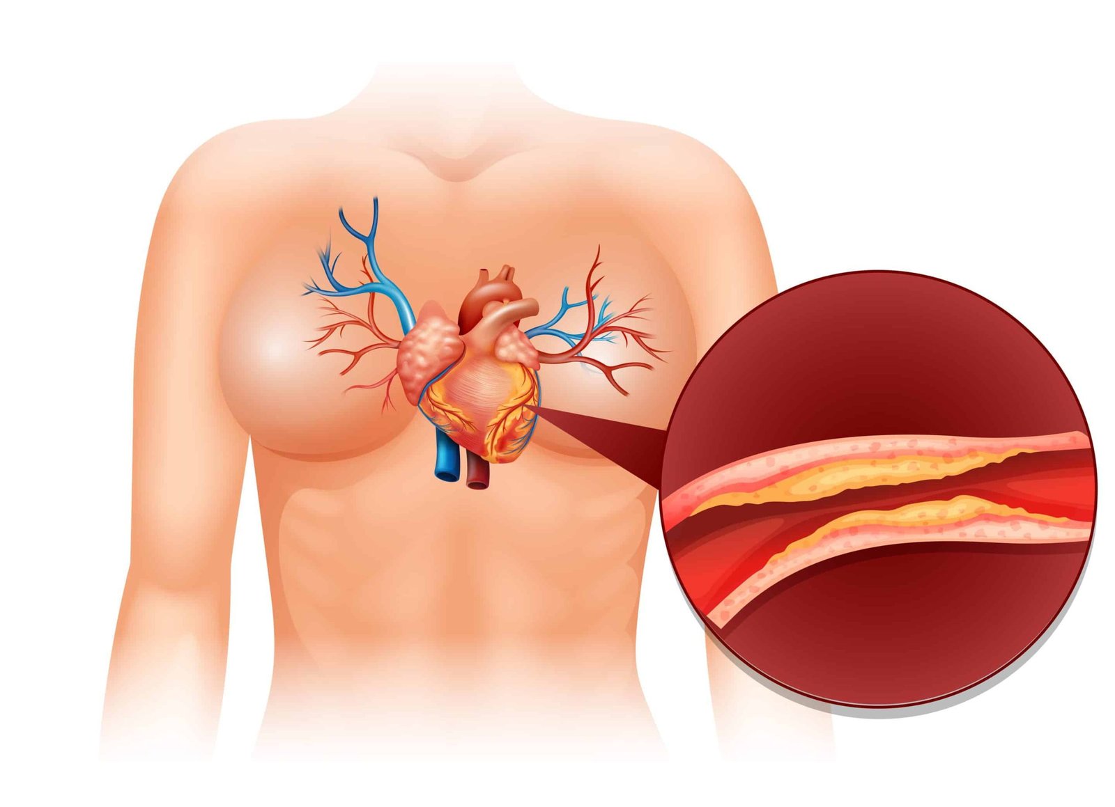 Heart Cholesteral in human